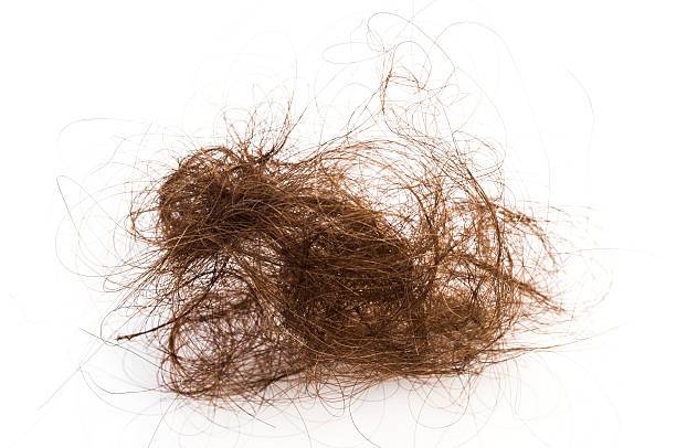 Balding problem women loss hair isolated